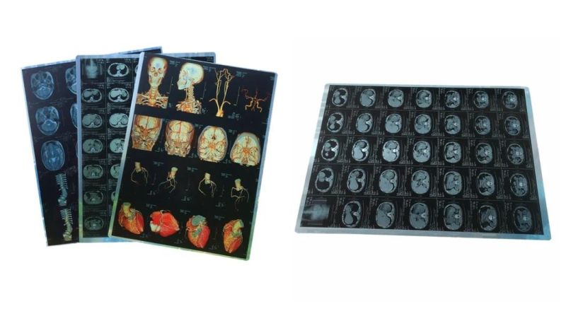 Digital X-ray System Dr Cr Medical Inkjet Film