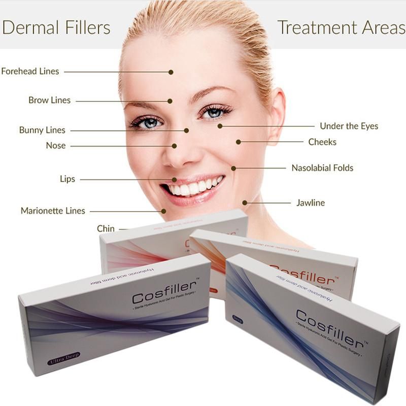Facial/Lips/Nose/Chin/Cheeks Hyaluronic Acid/Ha Injection Dermal Filler/Derm Filler