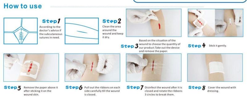 Adhesive Wound Closure Steri Strip Skin Wound Closure