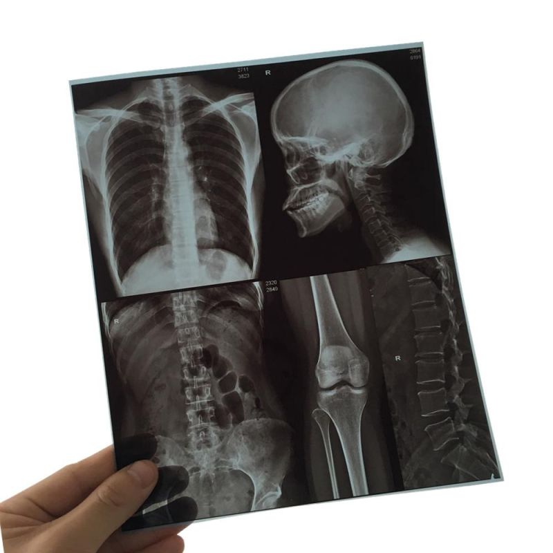 Pet Thermal/Inkjet Printer Using Blue Color Medical X-ray Film