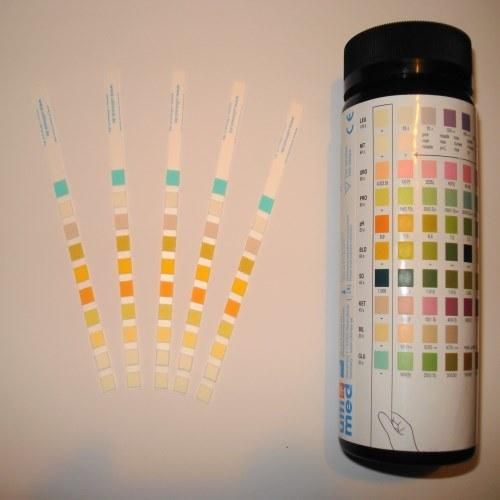 Urinalysis Test Strips/Urine Dipstick Test