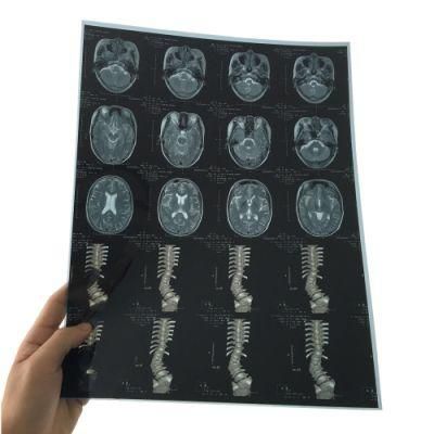 Blue Film/ Medical X-ray Film Same Clear Image as Carestream