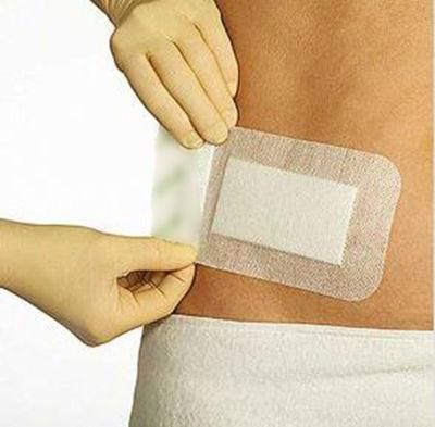 Trummed Waterproof Hydrocolloid Patch Medical Hydrocolloid Dressings Wound Healing