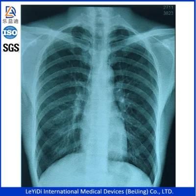 A4 and 10*14inch Medical Color Dry Ultrasound Paper/Film