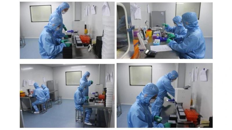 Medical Virus Test Collection Nylon Flocked Nasopharyngeal Nasal Swabs