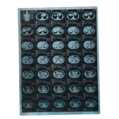 8*10 Inch Blue Base Thermal Printing X-ray Medical Film Substitute Agfa Film