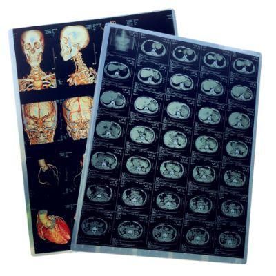 Drystar Dry Medical Film 35X43cm 14X17 in. Made in China