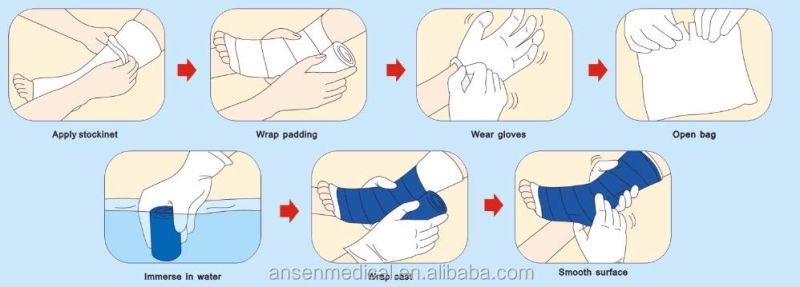 Medical Gypsum Plaster of Paris Bandage Orthopedic Fiber Glass Casting Tape