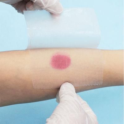 Hot Sale Surgical Sterile Paraffin Gauze Dressing/Pad/Swab
