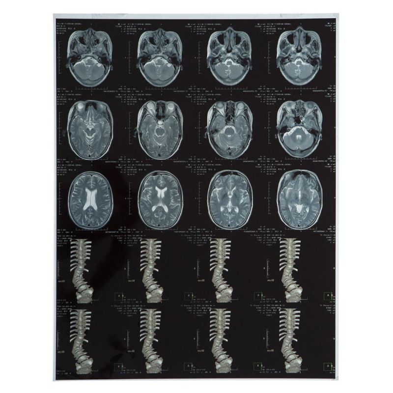 Doctors Physician Medical X-ray Image/Film for Hospital MRI & CT
