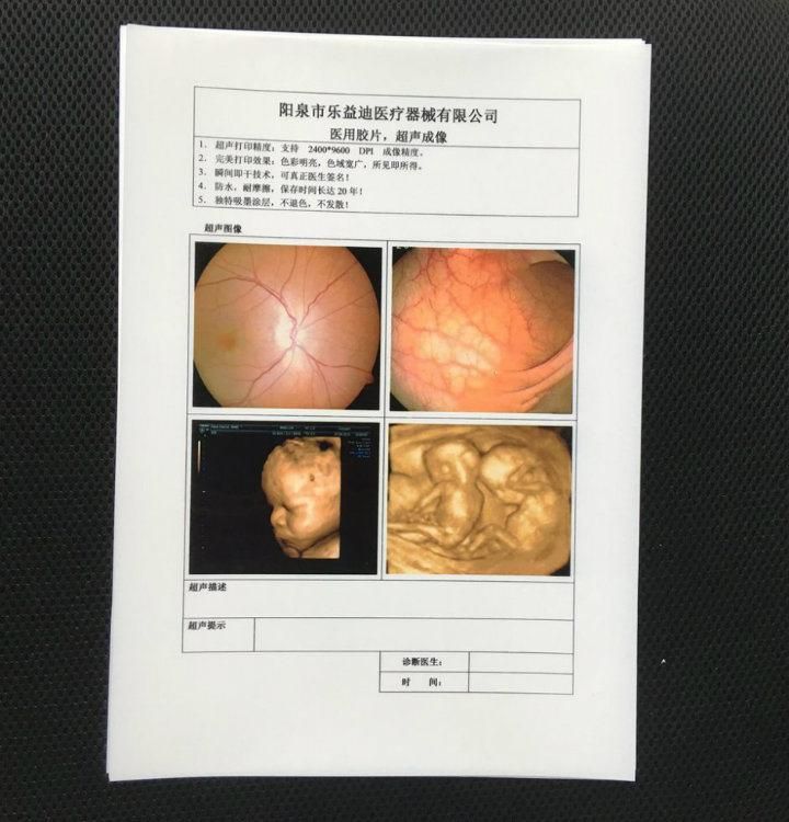 Hospital Usage A4 White Medical Dry Ultrasound X-ray Film / Pet Film
