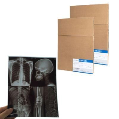 14*17 Inch Blue Inkjet X-ray Films for Cr, Dr