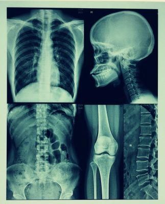 Free Sample 14&prime;&prime;x17&prime;&prime; Inkjet Printing Blue Based Medical Dry Film/Image