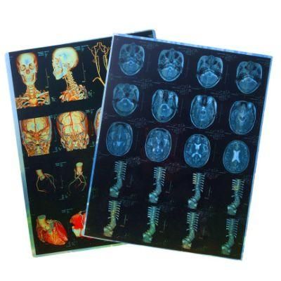 Medical Waterproof Inkjet Blue Film
