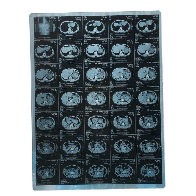 X-ray and Magnetic Resonance Imaging (MRI) Films