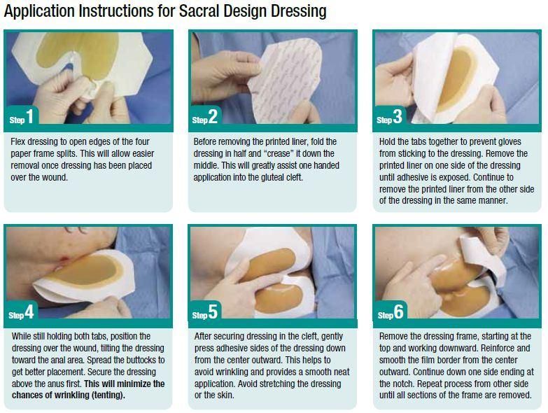 Medical Surgical Adhesive Hydrocolloid Wound Dressing