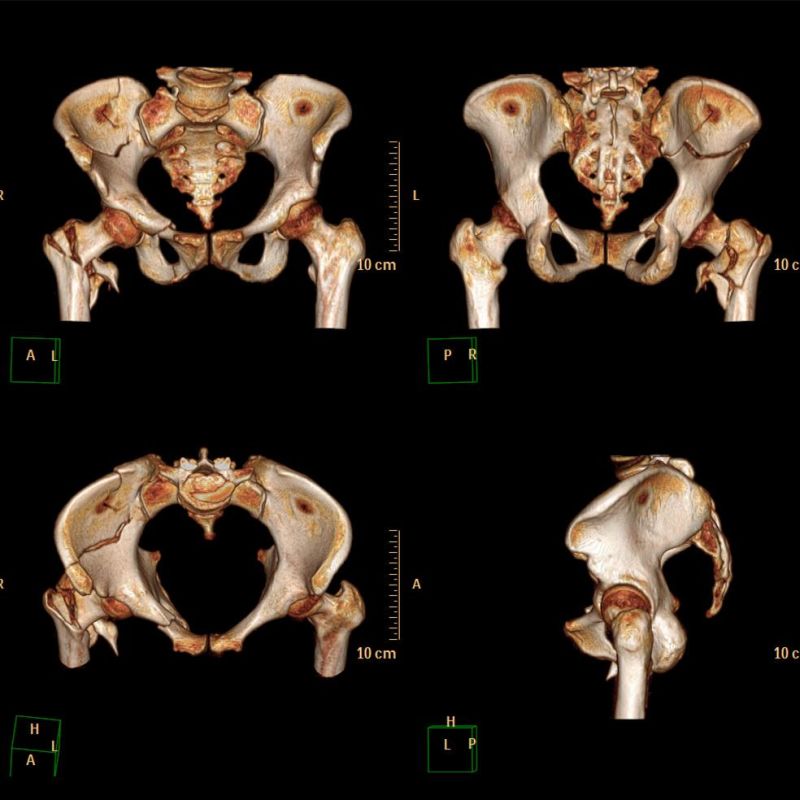 Pet Medical X-ray Laser Printing Film/Image