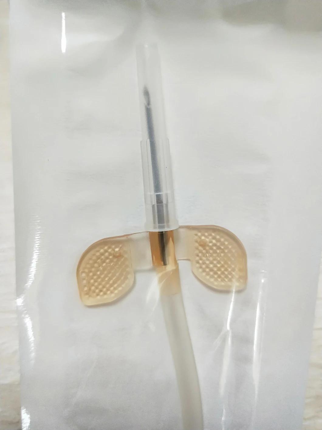 Dialysis AV Fistula Needle