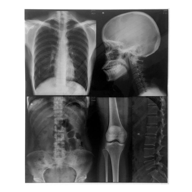 Radiology Dept. and Digitally Store Thermal Sensitive X-ray Image and Dry Film
