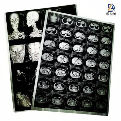 Medical 30*40cm Blue Sensitive X-ray Film
