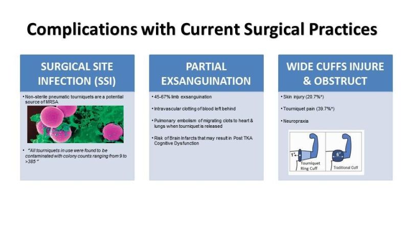 Single Used Exsanguinating Tourniquet Orthopedic Limb Surgery Easy to Use with Disposable Tourniquet Sterial Pneumatic Tourniquet