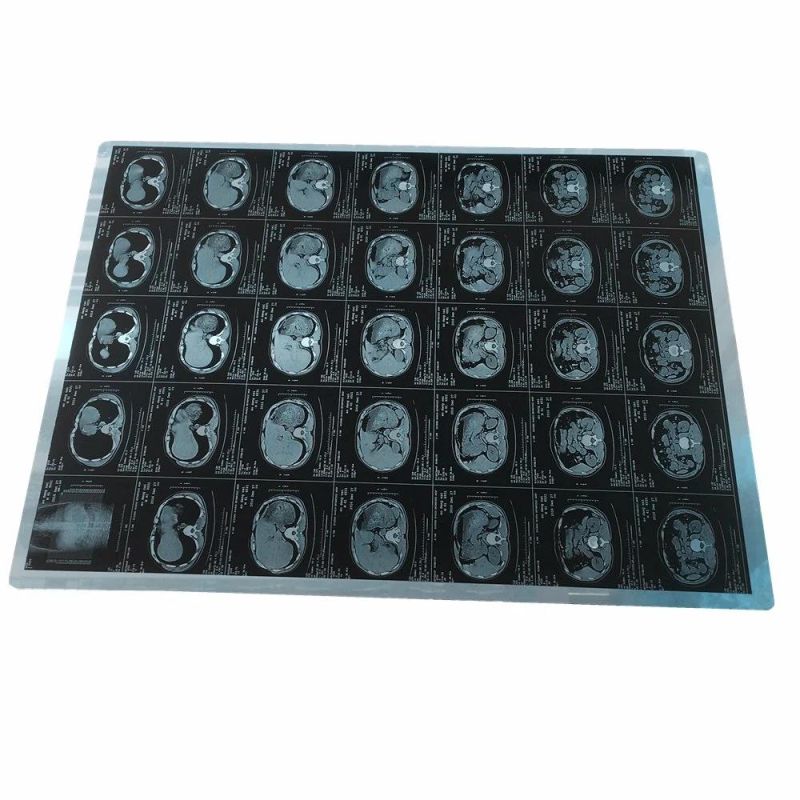 18X24 Cm Medical Laser X-ray Film Blue X-ray Images