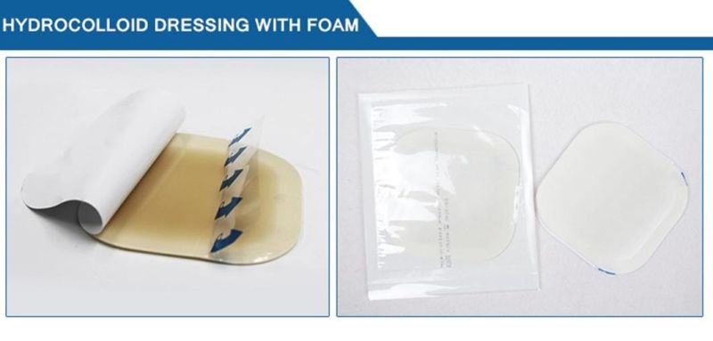 Calcium Alginate Wound Dressing Medical Disposable Consumables Equipment