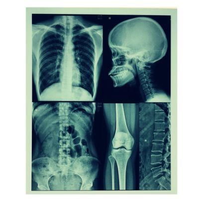 A3 and 13*14 Medical Inkjet Film for X-ray &amp; Ultrasound Blue Color