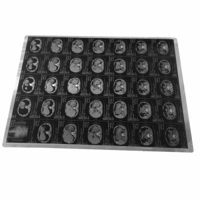 Disposable Blue Medical Laser Dry X-ray Films