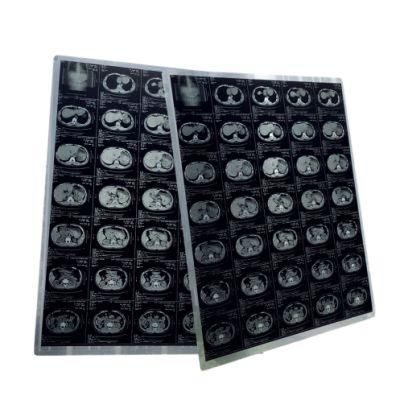 14*17 Laser Blue and White Medical X-ray Film for FUJI Xerox Laser Printer