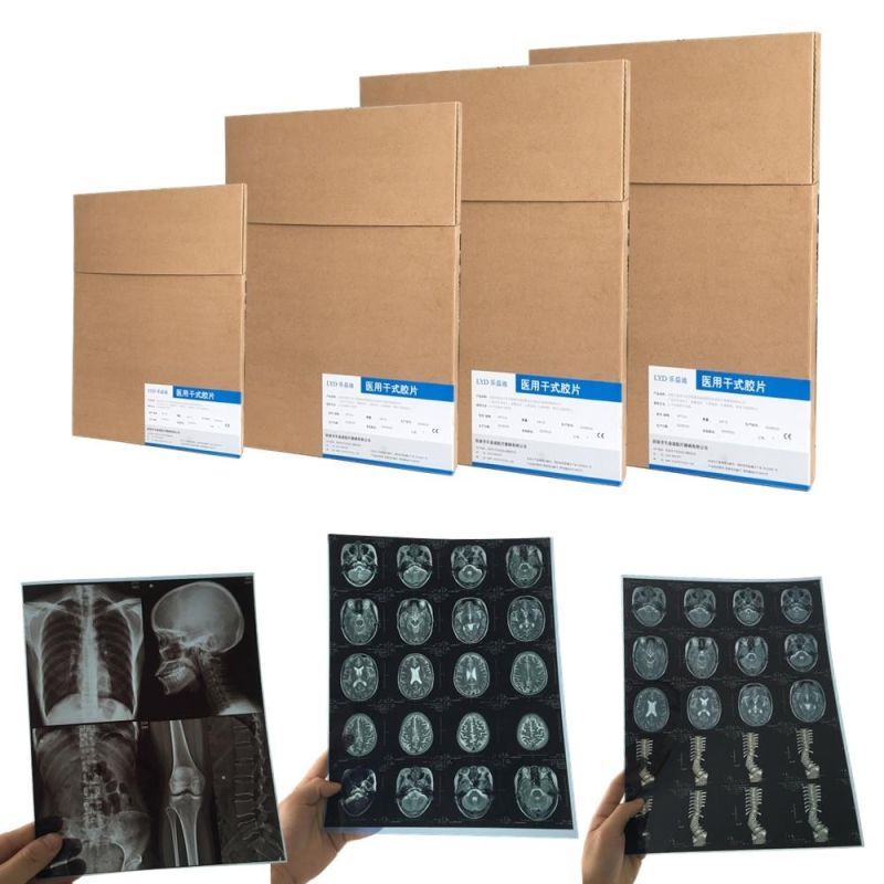 Blue Color MRI Medical Inkjet X Ray Films X Ray