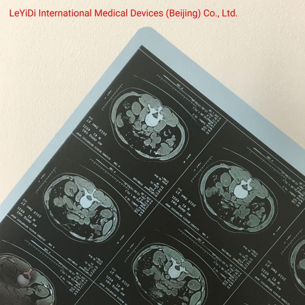Medical Dry Laser Films Diagnosis Printing