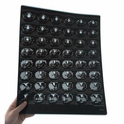 Agfa Drystar 5302/5503 Blue 8*10/14*17 Thermal Medical X-ray Film