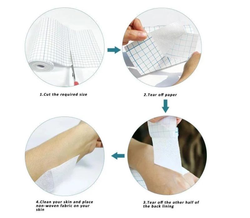 Mdr CE Approved Low Sensitization Non-Woven Medical Sterile Adhesive Tape