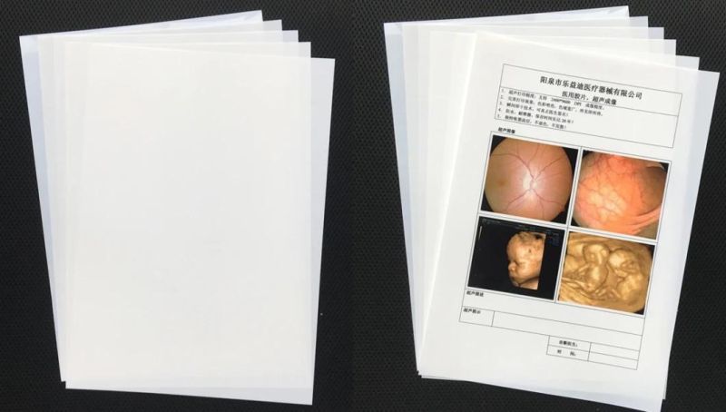 8X10 Inch and 14X17 Inch Medical X-ray Dry Laser Film