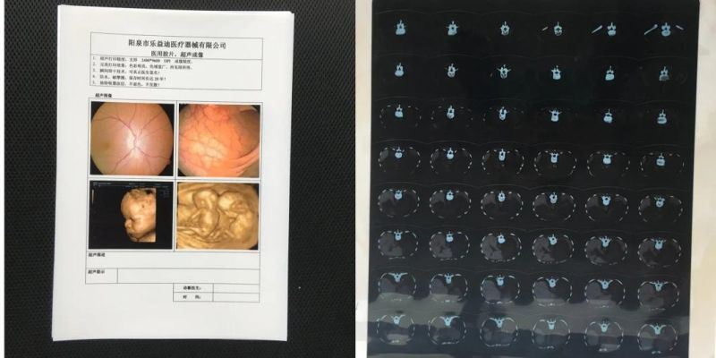 Images of Medical X-ray Film for FUJI Xerox 5005D Printer