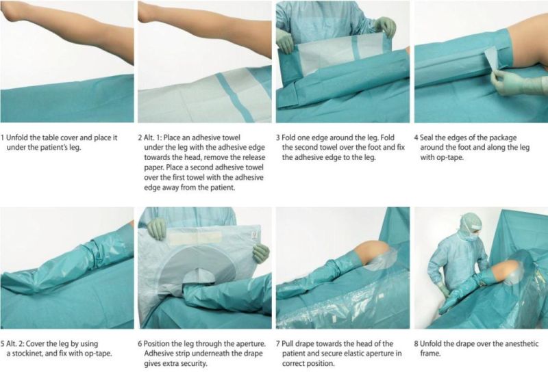 Disposable Surgical Hip Pack Disposable Hip Drape Pack SMS