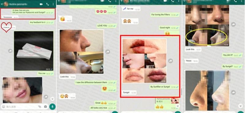 China Wholesale Mono-Phasic 24mg Ha Gel Lidocaine Injection Dermal Filler Hyaluronic Acid for Filling Facial Wrinkles