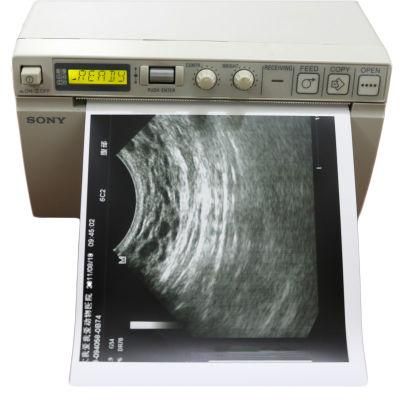Upp-110s Type I Ultrasound Thermal Glossy Paper Roll for Sony Medical Printer