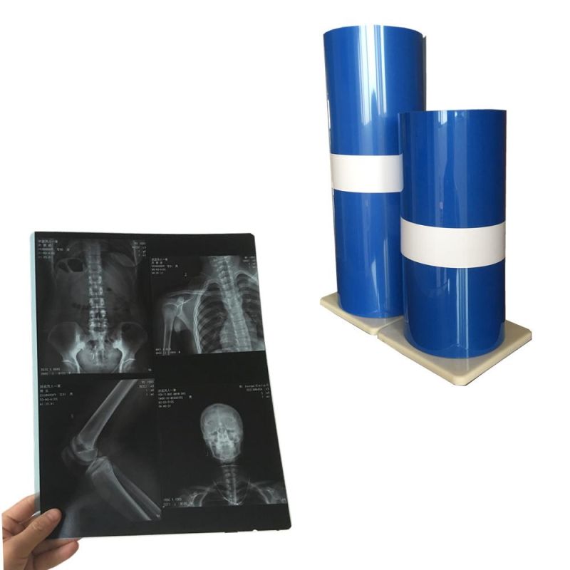 Thermal Medical Film Wholesale