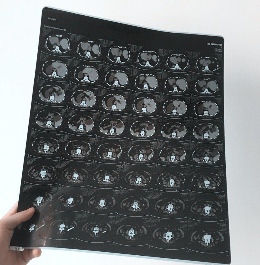 Medical Waterproof Inkjet Blue Film