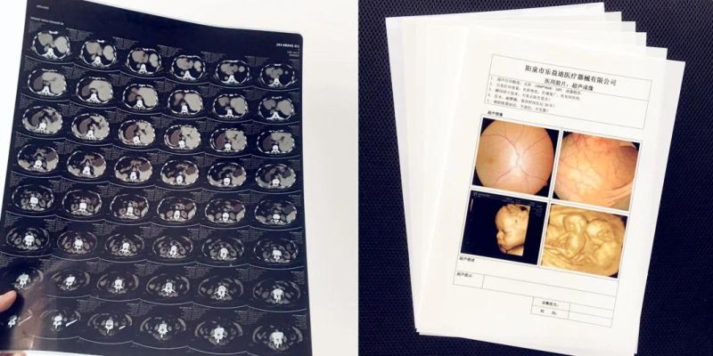 8 X 10 Inch Film That Is Blue Thermal Image and Print Media