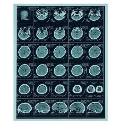 10*12 Inch Inkjet Printing Medical Film, X-ray Blue Medical Film for Epson Printers