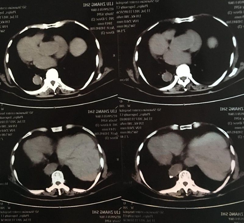 Pet Medical X-ray Laser Printing Film/Image