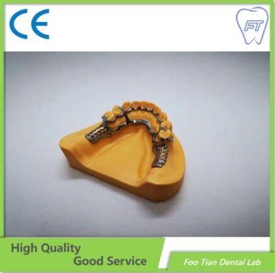 Professional Services Removable Denture Cast Partial Framework Dental Customized