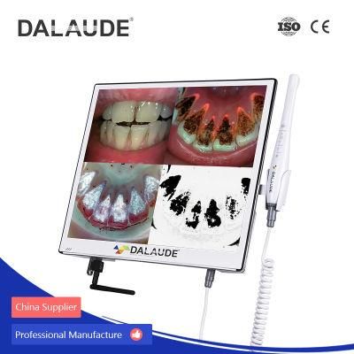 Unique Thinness Manufacture of Intra Oral Camera for Dental Laboratory
