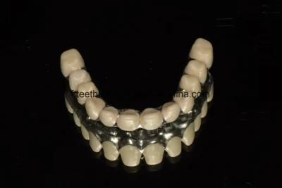 All Ceramic Dental Malo Implant Full Arch Bridge