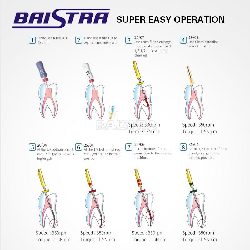 Good Quality Engine Use Root Canal Instrument Heat Activated Dental Endo Niti Files