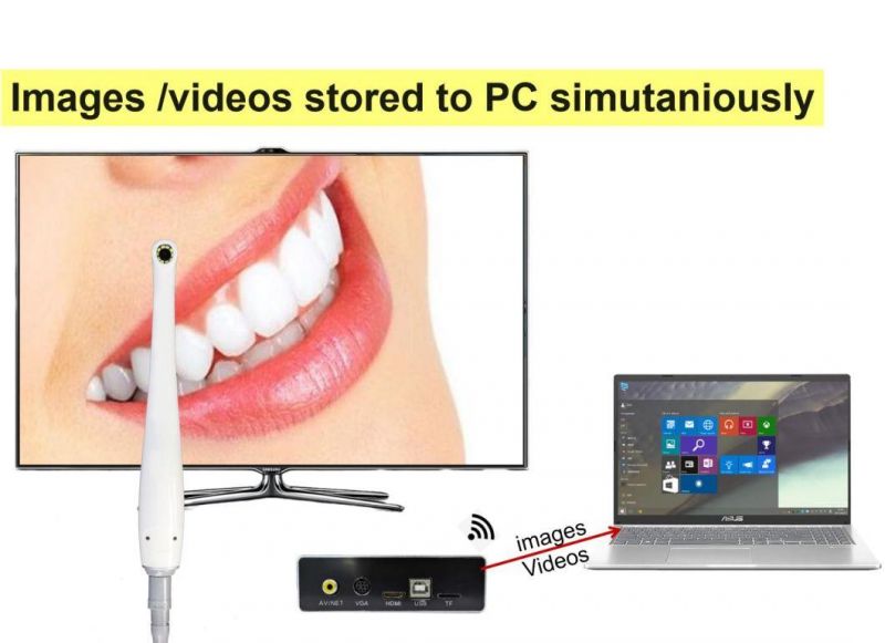 Factory Hot Sell TV Intraoral Camera A3m Best Dental Camera