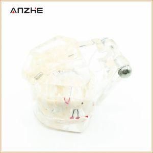 Good Price Dental Lab Dental Implant Restoration Model